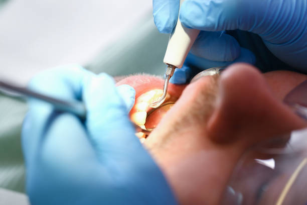 Best Dentist for Tooth Abscess  in Lufkin, TX