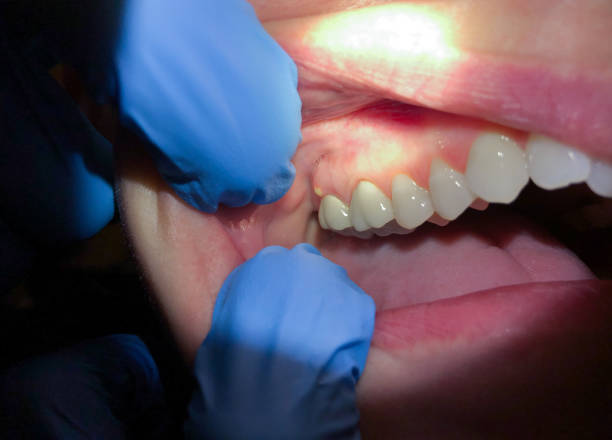 Best Cracked Tooth Emergency Dentist  in Lufkin, TX
